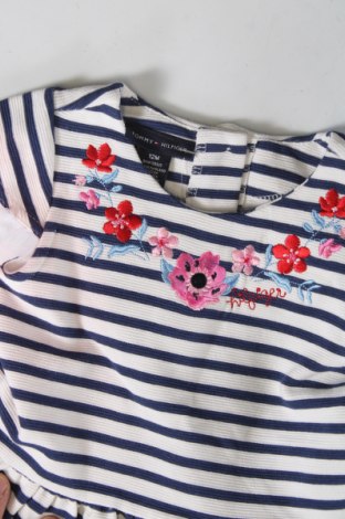 Kinderkleid Tommy Hilfiger, Größe 12-18m/ 80-86 cm, Farbe Mehrfarbig, Preis € 52,00