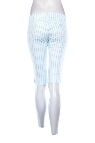 Női rövidnadrág Unbranded, Méret M, Szín Sokszínű, Ár 1 239 Ft