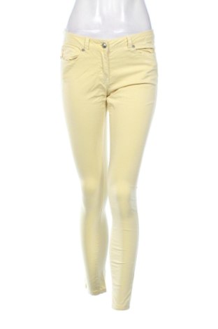 Damenhose Silvian Heach, Größe M, Farbe Gelb, Preis 10,67 €, #137733611