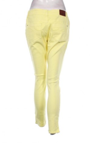 Γυναικείο Τζίν DKNY Jeans, Μέγεθος M, Χρώμα Κίτρινο, Τιμή 6,99 €